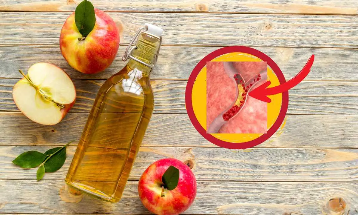 Cómo Reducir el Colesterol con Vinagre de Manzana
