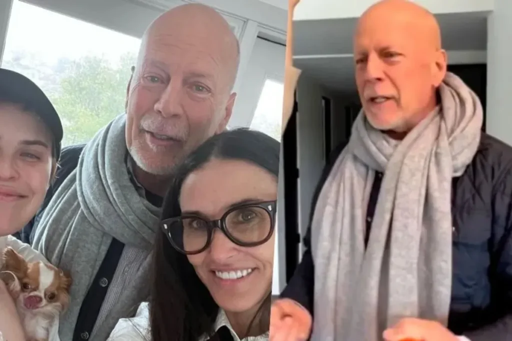 Enfermedades que padece Bruce Willis